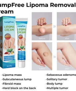 DermaFix Lipoma Removal Cream