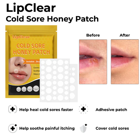 LipClear Cold Sore Honey Patch