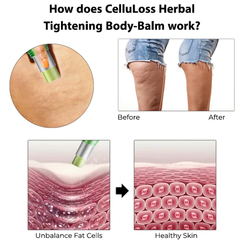 CelluLoss Herbal Tightening Body-Balm