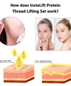 France InstaLift Protein Thread Lifting Set