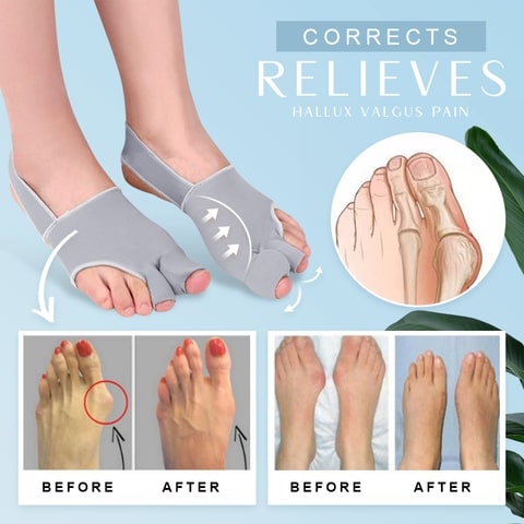 Elastic Two Toes Hallux Valgus Corrector