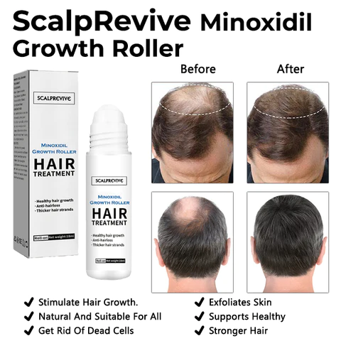 Oveallgo ScalpRevive PRO Minoxidil Growth Roller