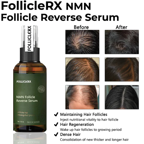 FollicleRX NMN Follicle Reverse Serum