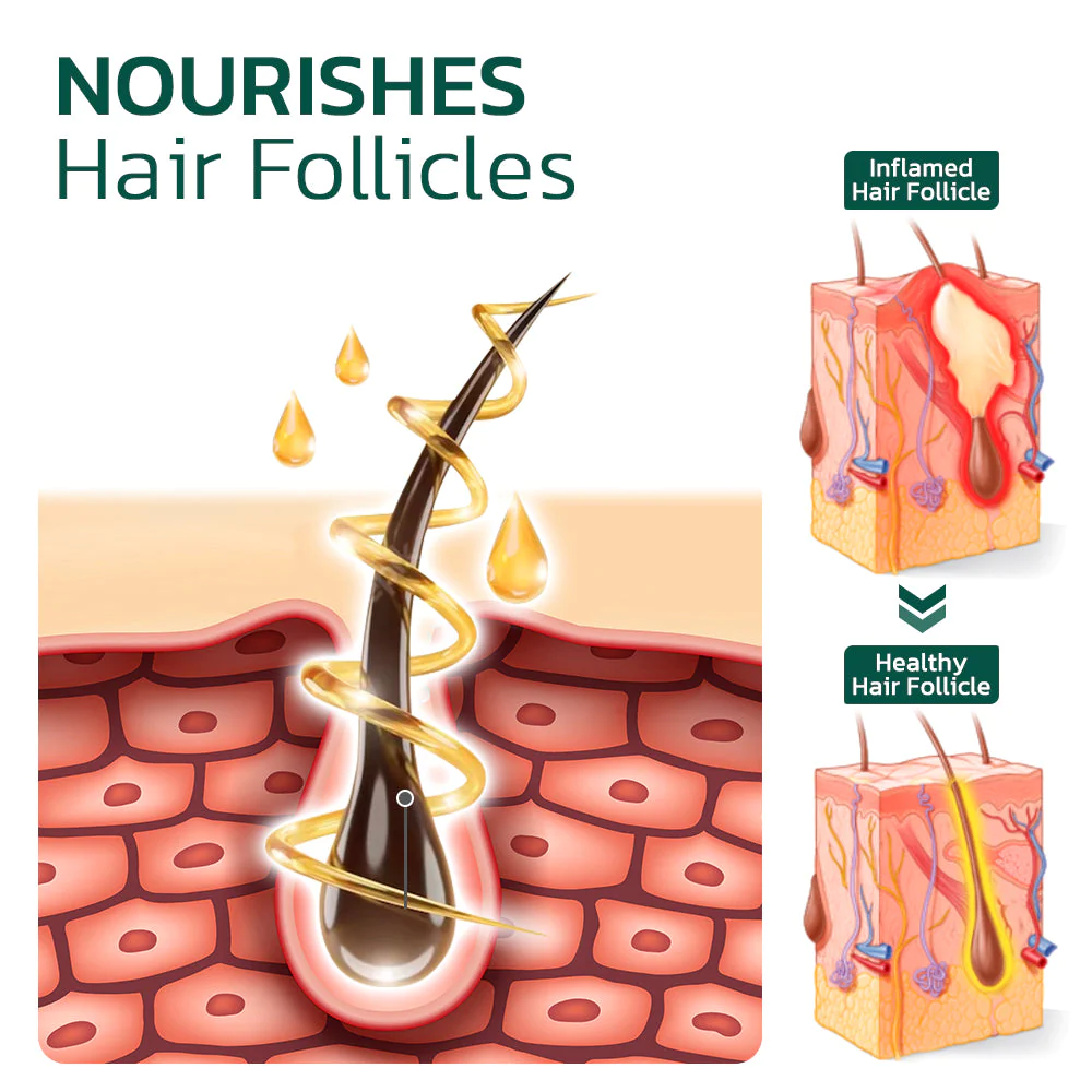 GFOUK Scalp Folliculitis Therapy Oil