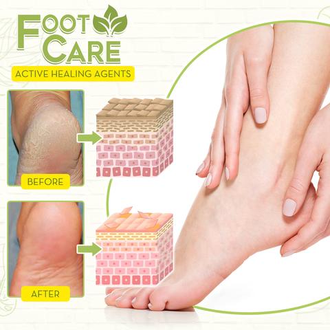 Fungal Reverse Herbal Treatment Foot Soak