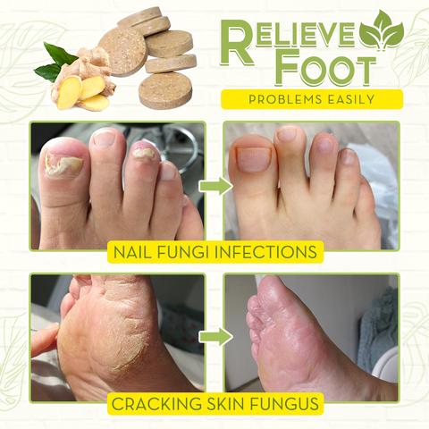 Fungal Reverse Herbal Treatment Foot Soak