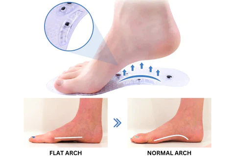 Oveallgo VeinCare MagAcupoint Reflexology Insole