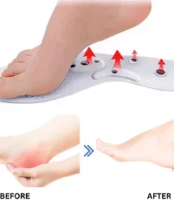 Oveallgo VeinCare MagAcupoint Reflexology Insole