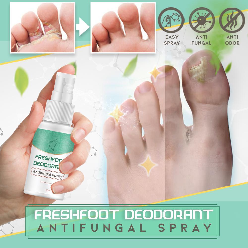 Fresh Foot Deodorant Antifungal Spray