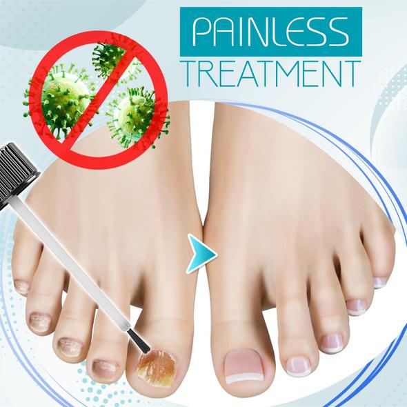 Fungal Nail Renewal Gel