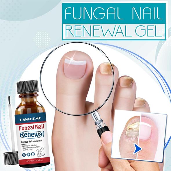 Fungal Nail Renewal Gel