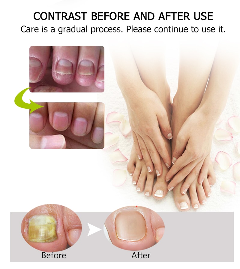 Toe Be Health Instant Beauty Gel