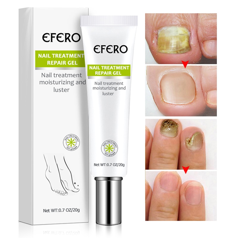 Toe Be Health Instant Beauty Gel