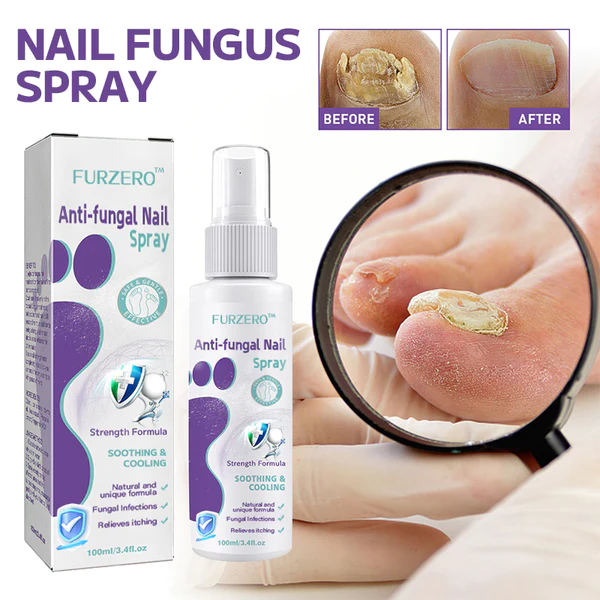 FurzeroAnti-fungal Nail Spray