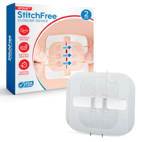 GFOUK StitchFree Closure Device