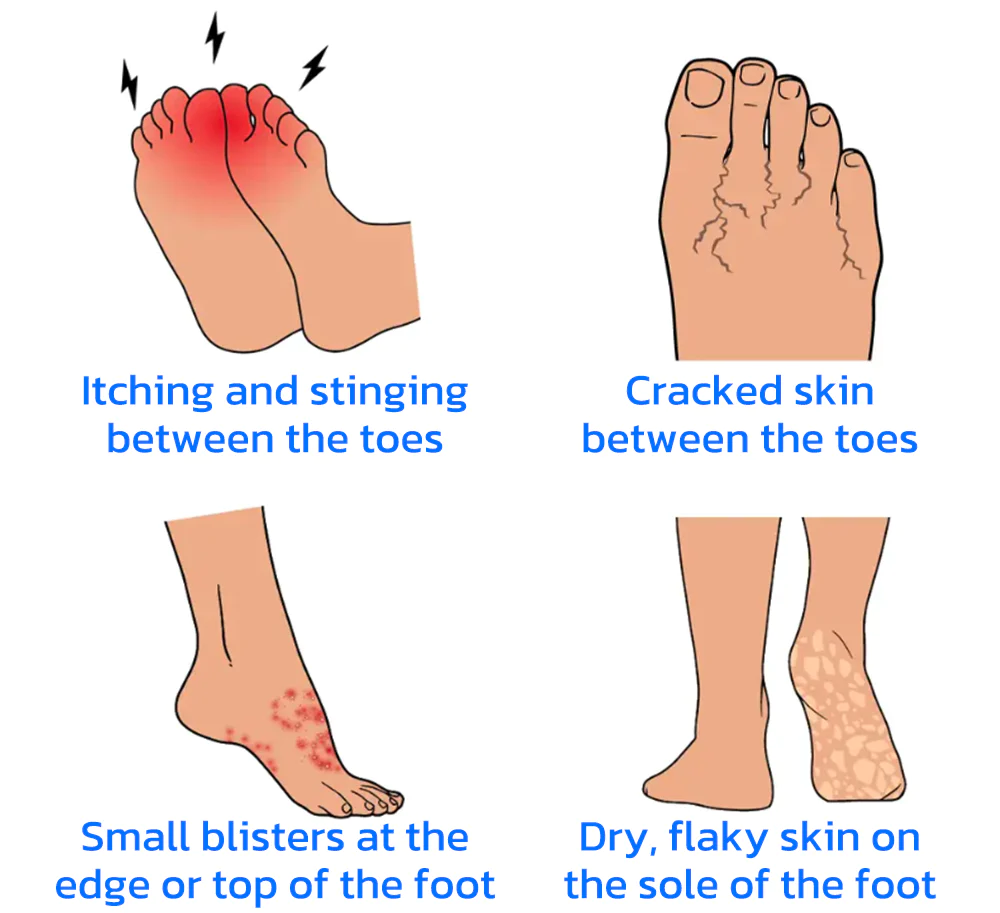 German Antifungal Microcapsules Hygienic Socks