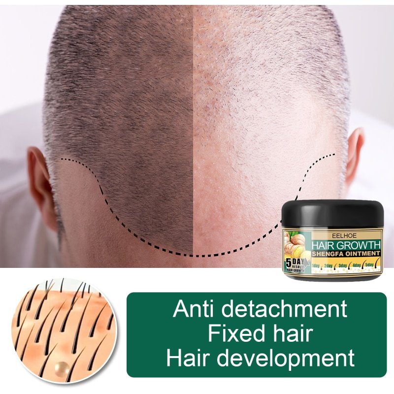 Ginger Hair Regrowth Cream