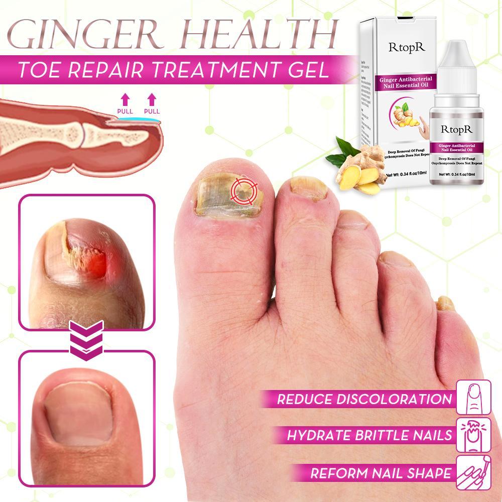 Ginger Health Toe Repair Treatment Gel