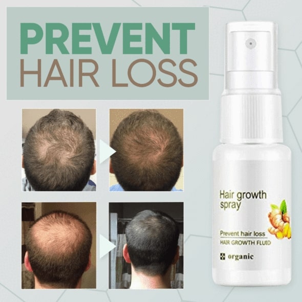 GingerGrowth Hair Regrow Spray