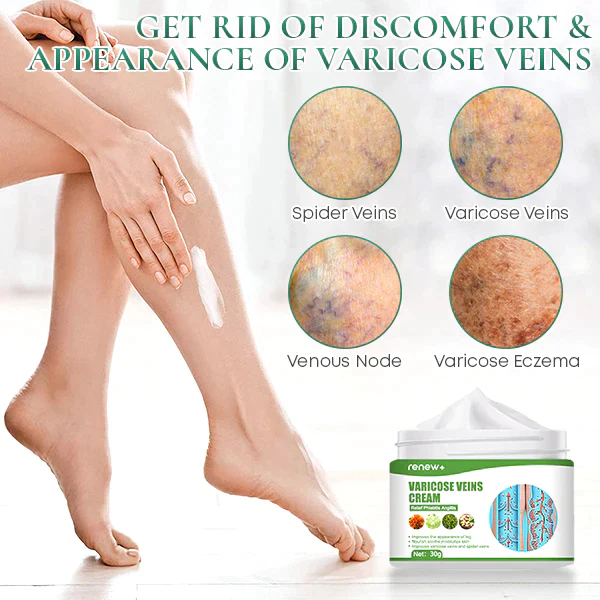 RENEW+ Varicose Veins Cream