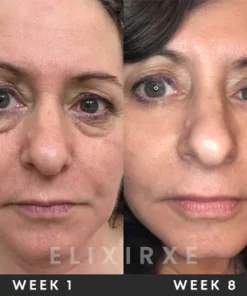 ElixirXE Nutriperfect Eye Serum