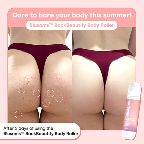 Blusoms BackBeautify Body Roller