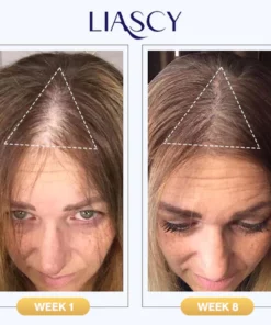 Liascy Shine Anti-Thinning Treatment