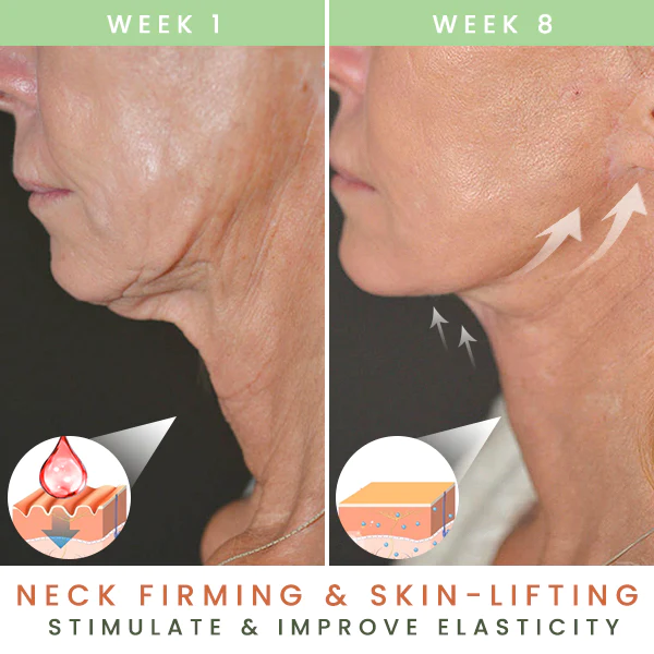 MyOeganix Lines Gone Neck-Gel