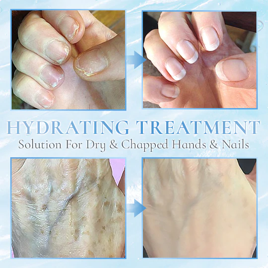 Hyaluronic Acid Hand Care Essence