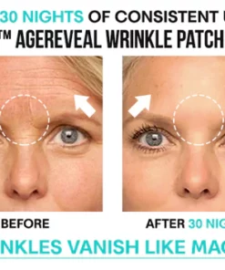 Liascy AgeReveal Wrinkle Patch Combo