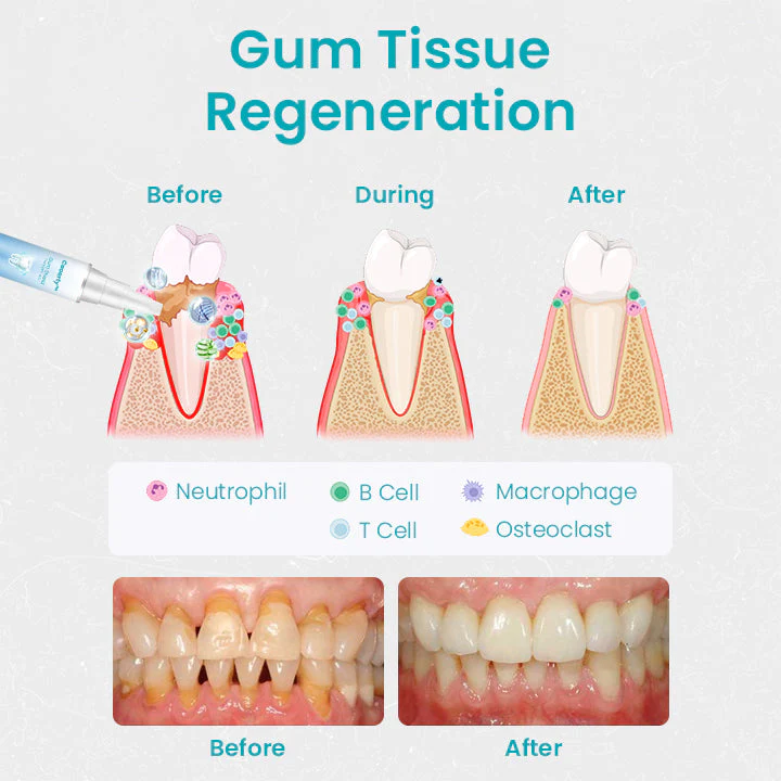 Oveallgo Gum Shield Therapy Gel