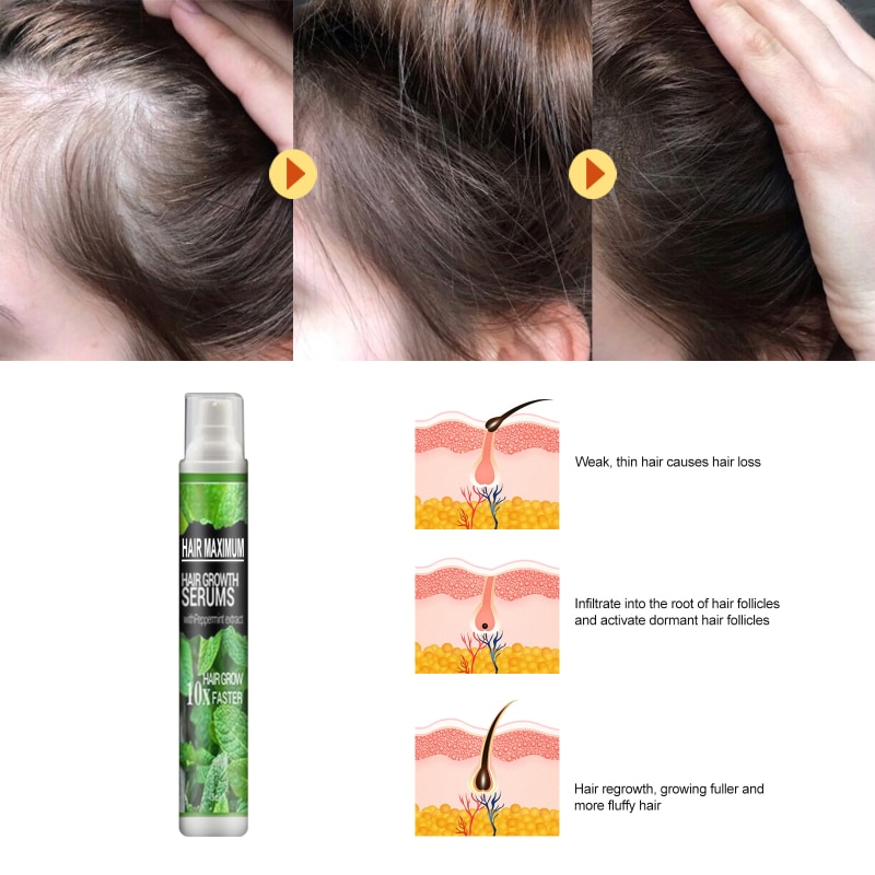 Hair Growth Essence Spray