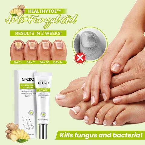 HealthyToe Anti-Fungal Gel