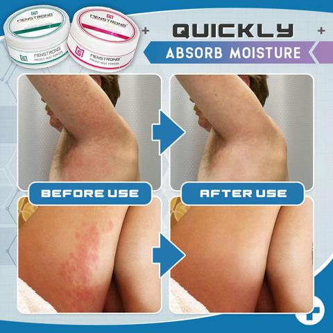 Heat Rash Repair Powder