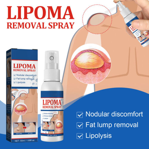 Herbal Lipoma Removal Spray