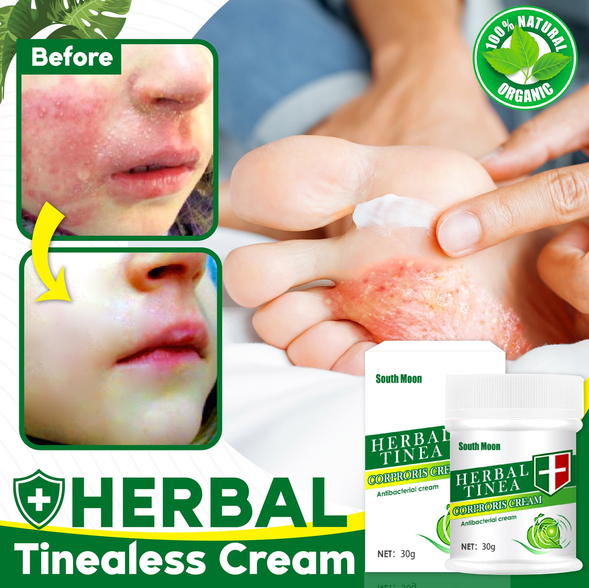 Herbal Tinealess Cream