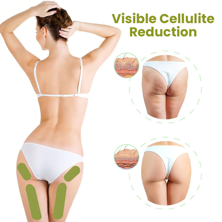 Oveallgo HerbalFirm PURE Cellulite Reduction Patches