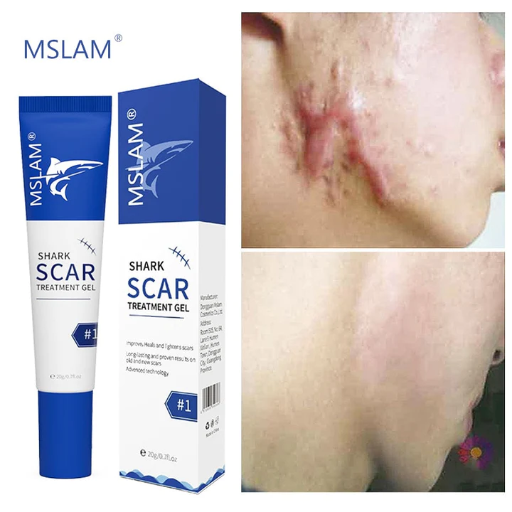 High Purity Silicone Scar Treatment Gel