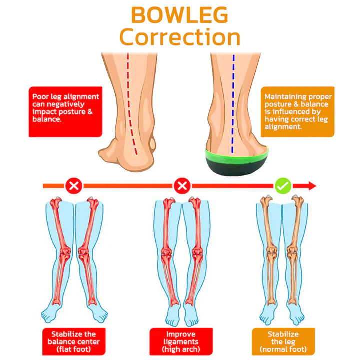 GFOUK BowlegOut Tourmaline Alignment Calcium Insoles