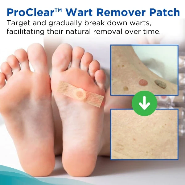 ProClear Wart Remover Patch