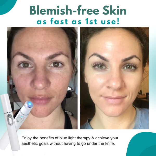 SkinMedica BlueLight Skin Spot Remover