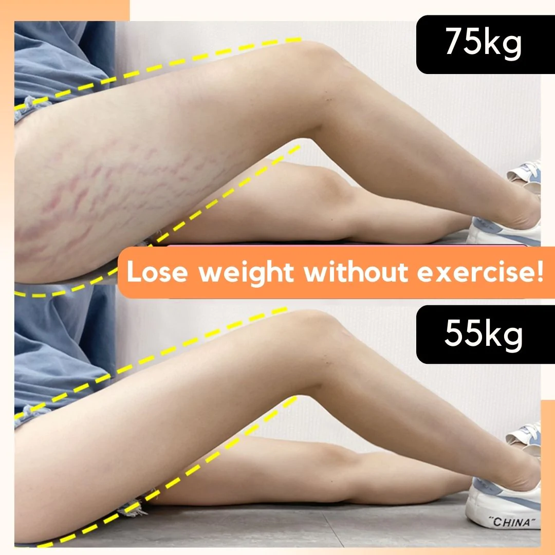 Reshape+ Leg Fat Burning Cream