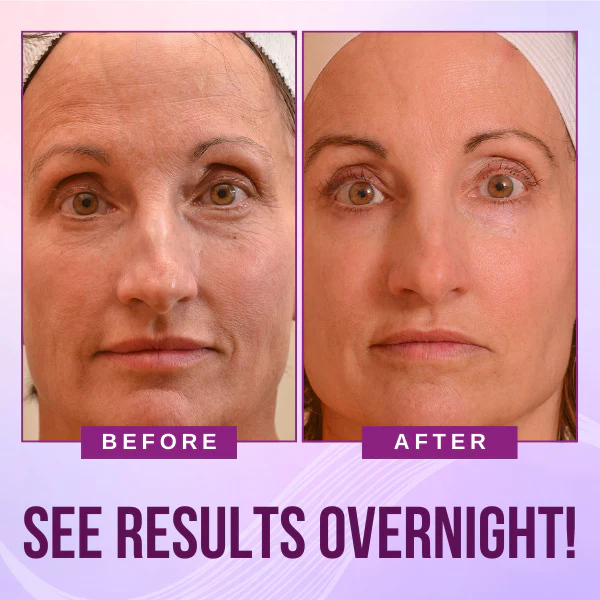 FaceLift Anti-wrinkle Patch