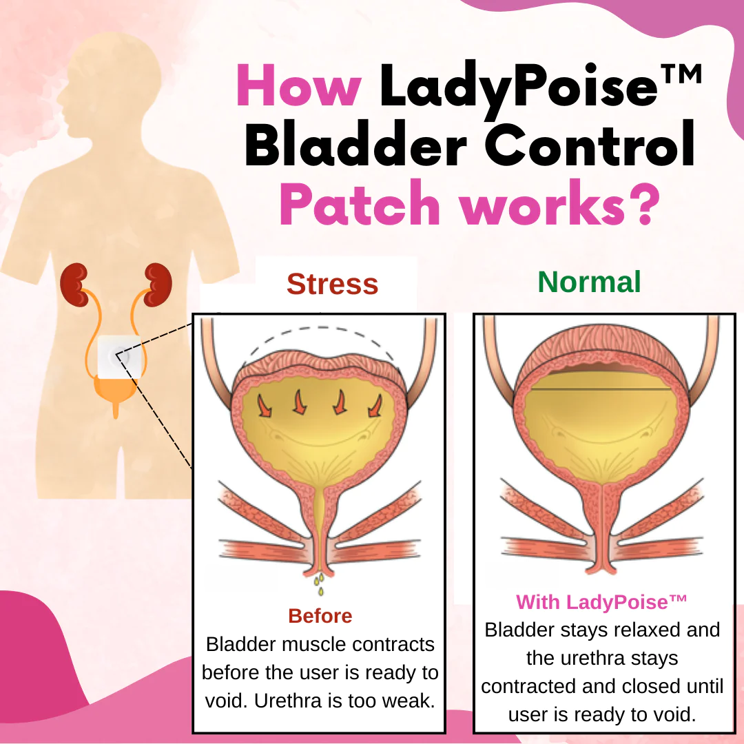 LadyPoise Bladder Control Patch