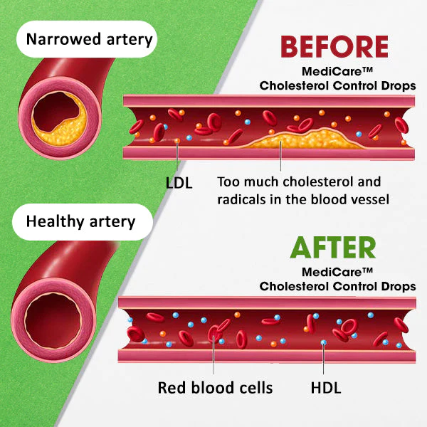 MediCare Cholesterol Control Drops