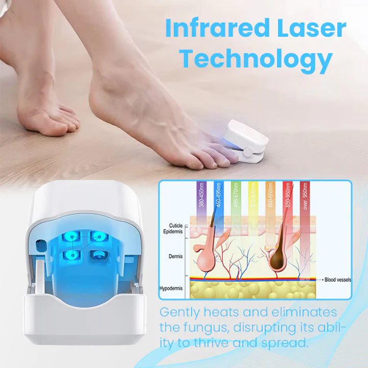 Ceoerty FungiGuard Nail Laser Therapy Device