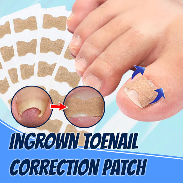 Ingrown Toenail Correction Patch