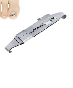 Toenails Correction Stainless Steel Clip Buckle