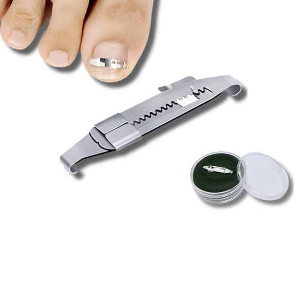 Toenails Correction Stainless Steel Clip Buckle