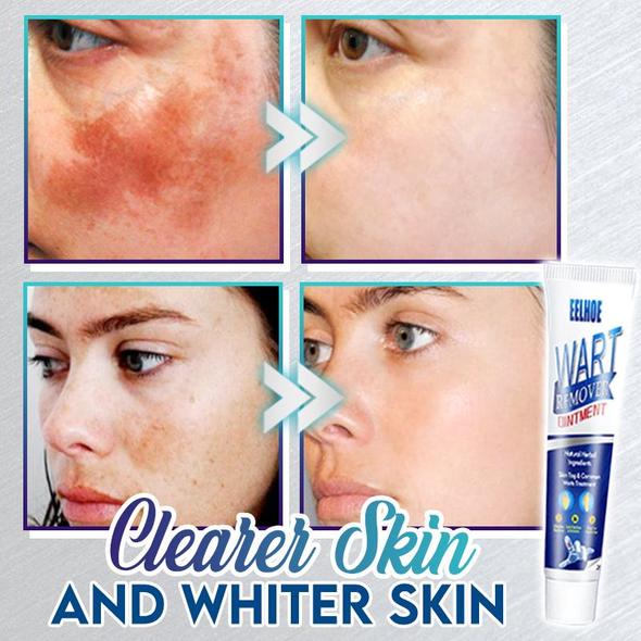 Instant Blemish Removal Gel